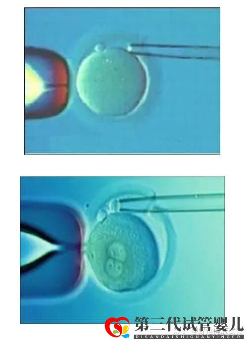 好運(yùn)健康三代試管知男女的必經(jīng)之路—胚胎活檢術(shù)(圖3)