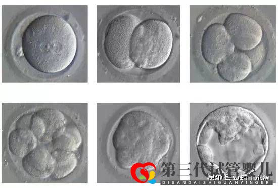 試管嬰兒移植后多久算成功(圖1)