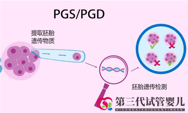 為什么很多人選擇去俄羅斯做試管嬰兒呢(圖1)