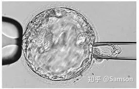 第三代試管嬰兒真的最好最先進(jìn)嗎國(guó)內(nèi)哪里可以做(圖5)