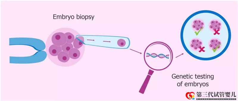 一個(gè)典型的PGD三代試管治療周期是怎樣的？(圖1)