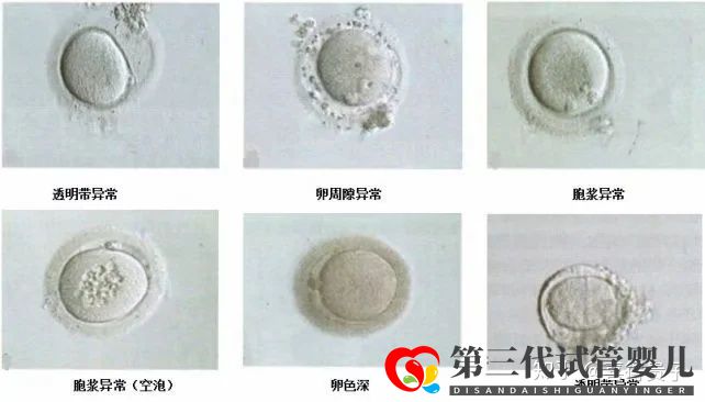 夫妻染色體正常,但胚胎染色體異常,什么原因引起(圖9)