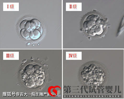 胚胎能看出來男女嗎？(圖1)