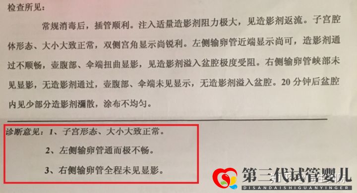 女人做了試管人就廢了其中的辛酸苦不堪言,但我不(圖1)