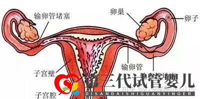 人工授精跟試管嬰兒的區(qū)別(圖5)