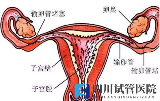 成都兩側(cè)輸卵管堵塞想要孩子，聽說試管嬰兒是最好的選擇(圖1)