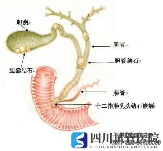 四川結(jié)石病醫(yī)院等級專業(yè)品牌平價透明費用統(tǒng)一規(guī)范(圖3)